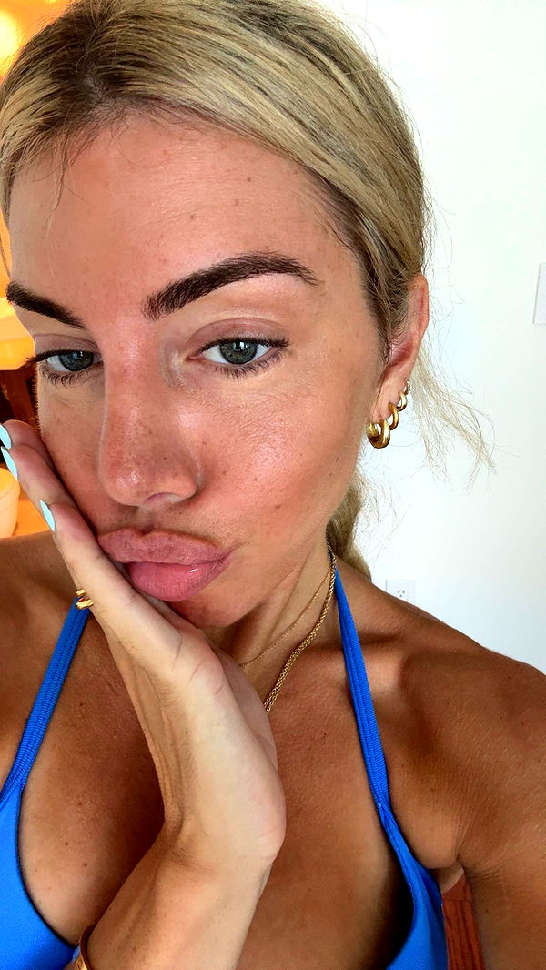 bellarenaldii image ~ Altpins