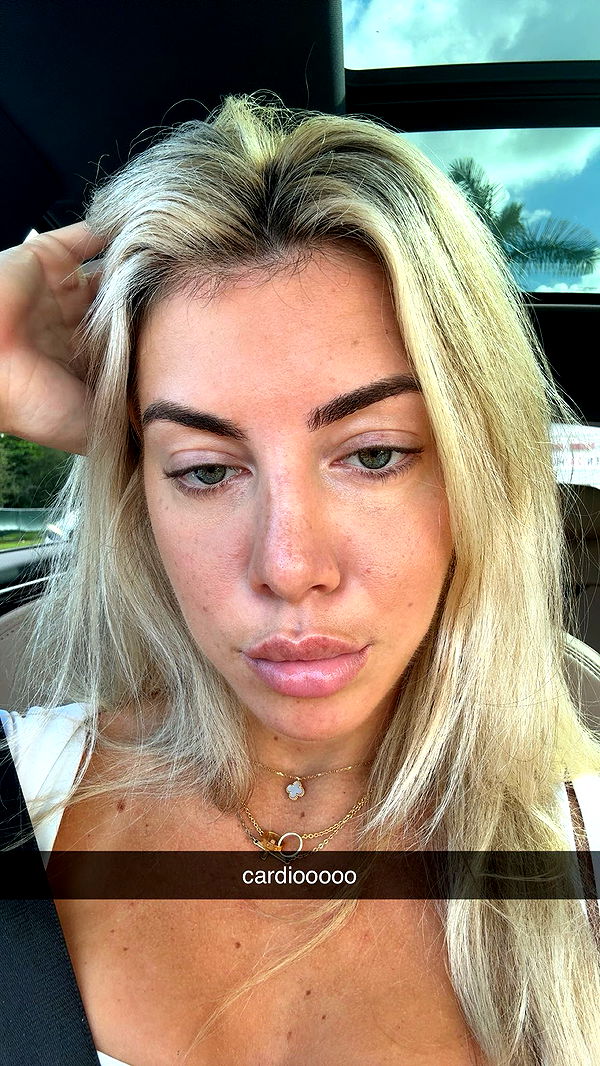 bellarenaldii image ~ Altpins