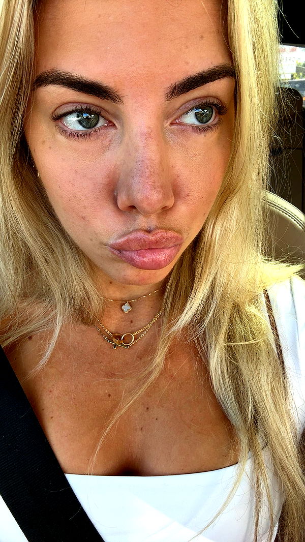 bellarenaldii image ~ Altpins