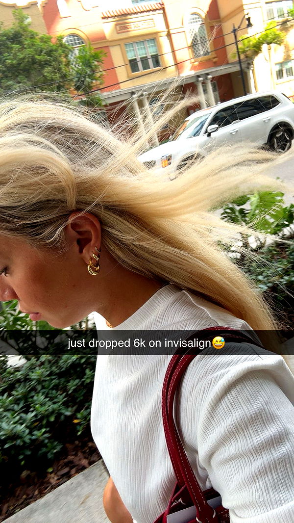 bellarenaldii image ~ Altpins