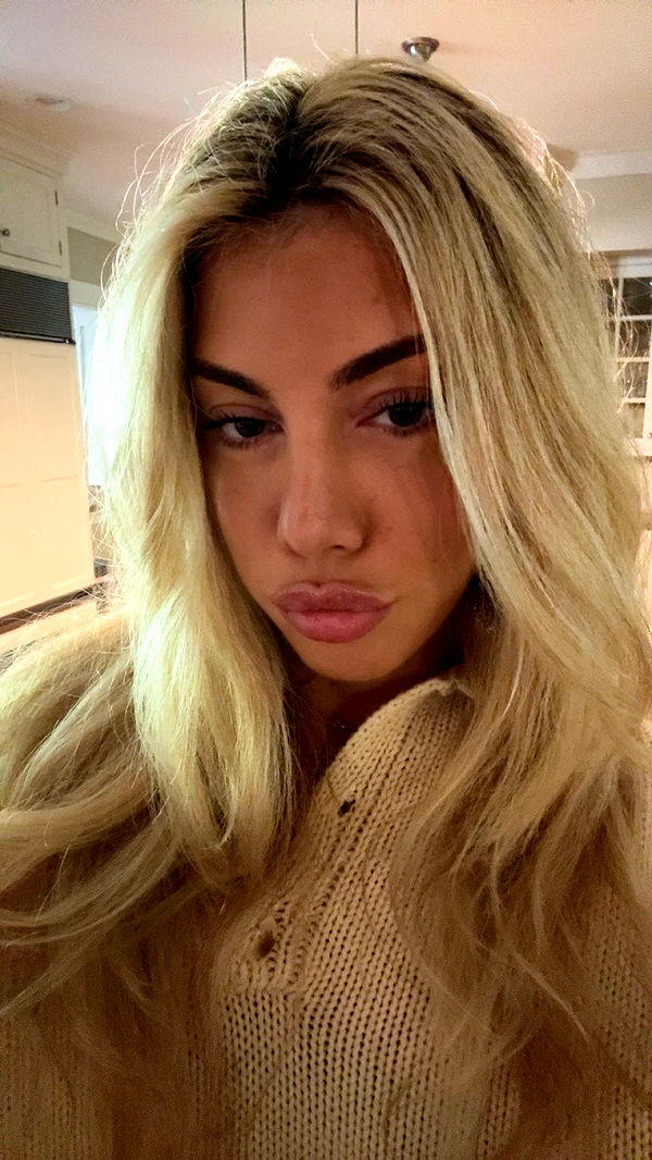 bellarenaldii image ~ Altpins