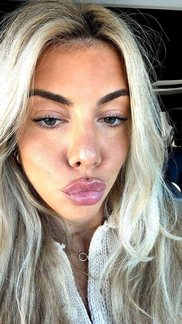 bellarenaldii image ~ Altpins