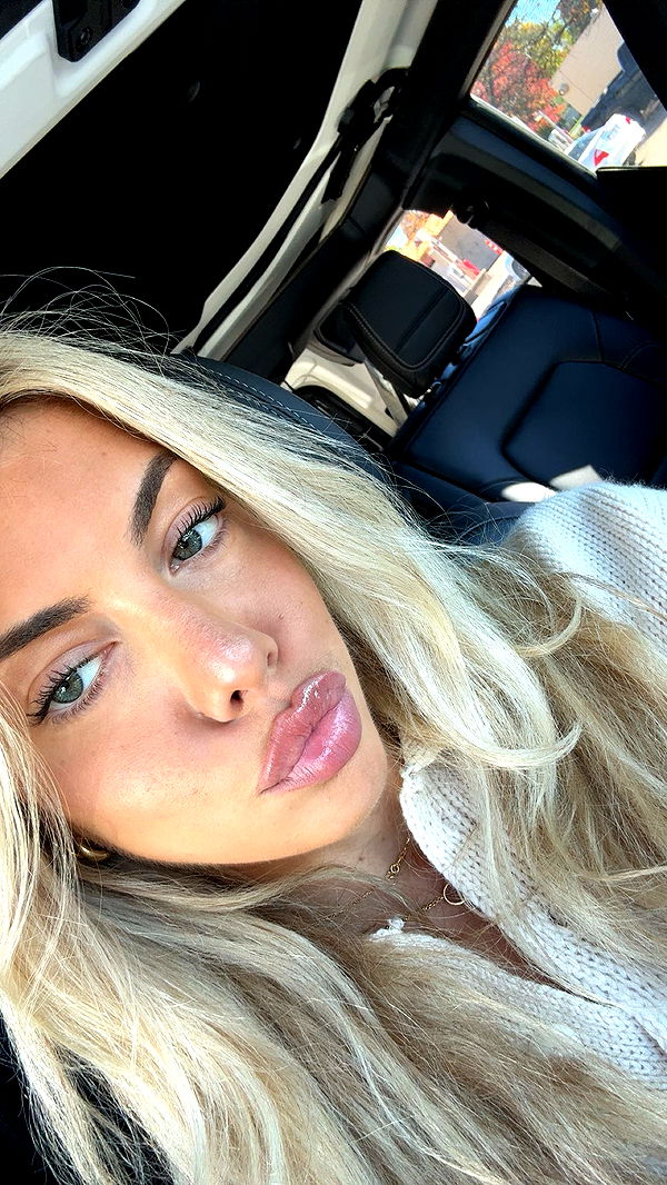 bellarenaldii image ~ Altpins