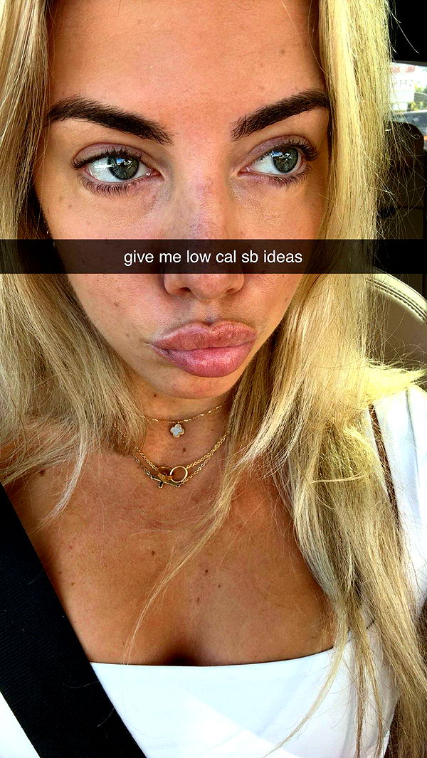 bellarenaldii image ~ Altpins