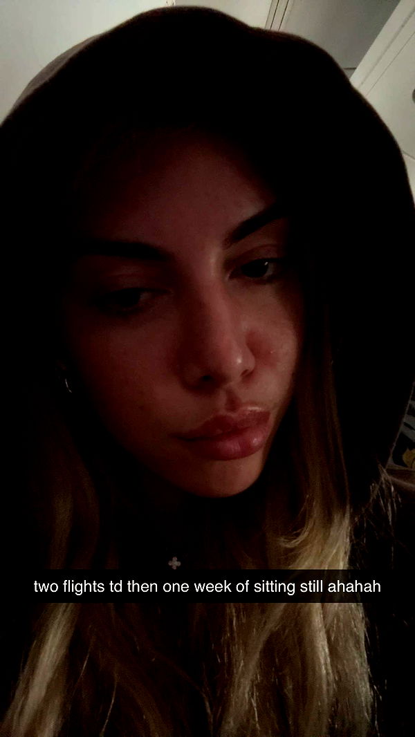 bellarenaldii image ~ Altpins