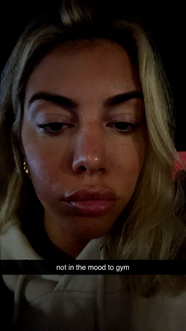 bellarenaldii image ~ Altpins