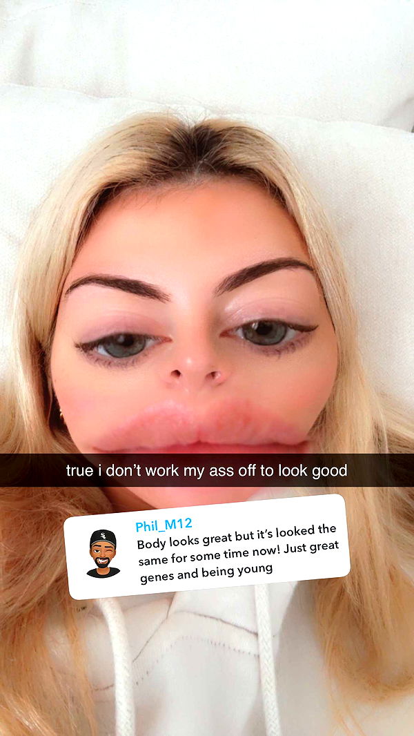 bellarenaldii image ~ Altpins