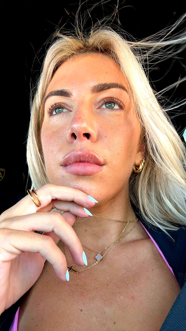 bellarenaldii image ~ Altpins