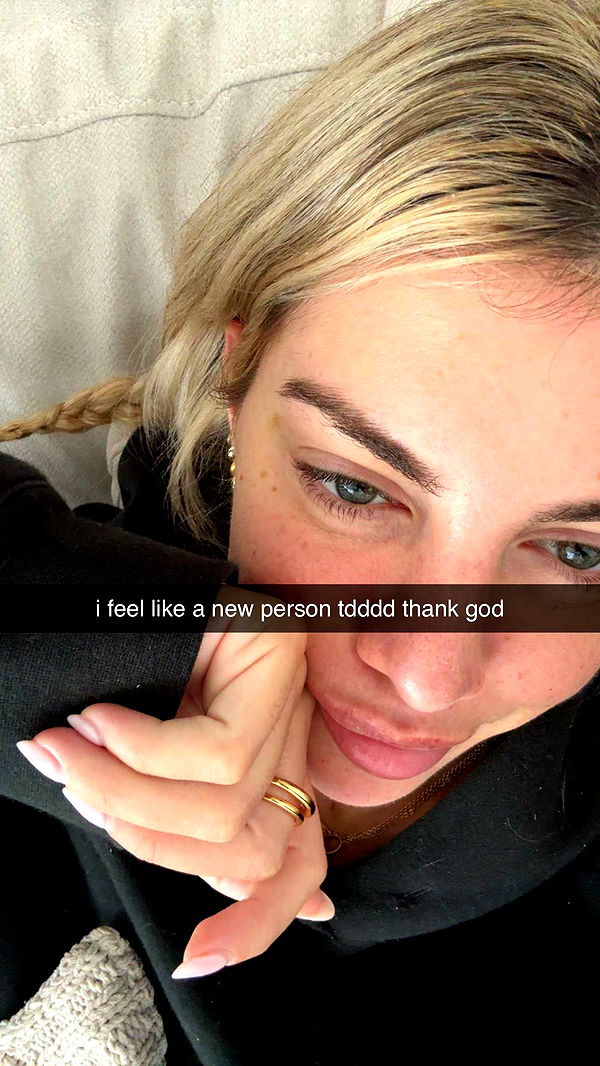 bellarenaldii image ~ Altpins