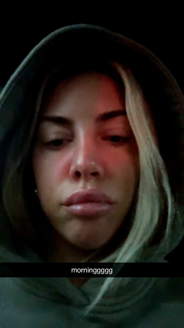 bellarenaldii image ~ Altpins