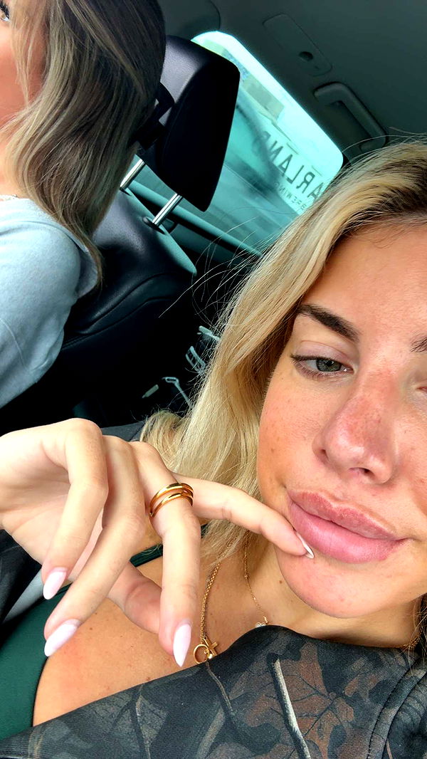 bellarenaldii image ~ Altpins