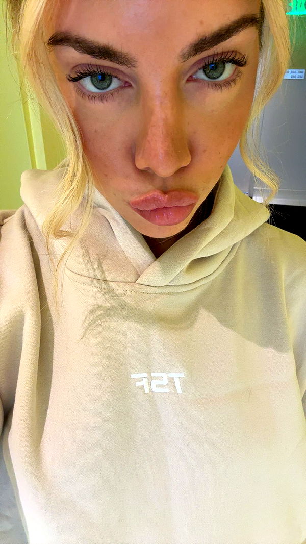 bellarenaldii image ~ Altpins