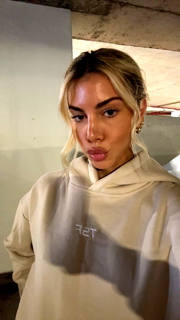 bellarenaldii image ~ Altpins