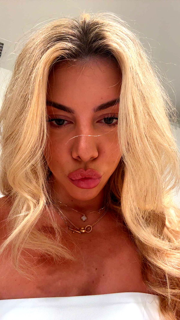 bellarenaldii image ~ Altpins