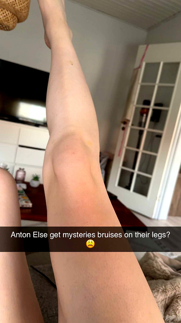 bibblepublic snapchat image archive image