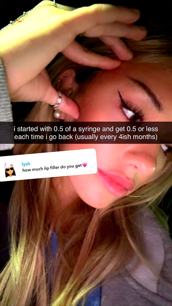 breckiehill image ~ Altpins