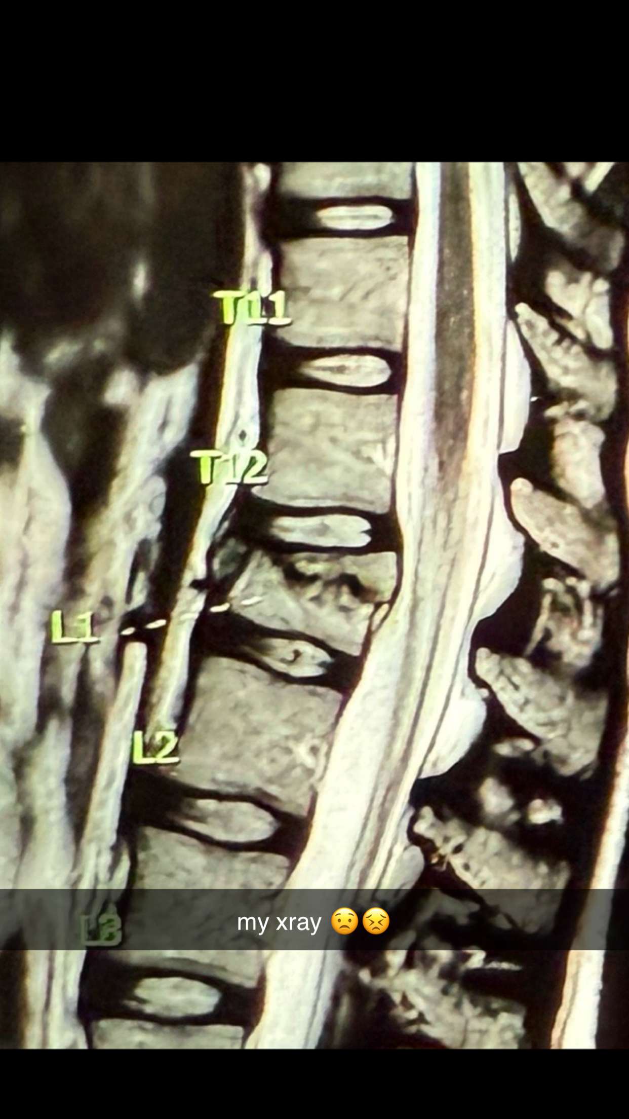 breckiehill snapchat image archive image