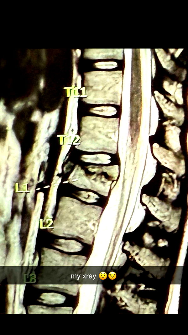 breckiehill image ~ Altpins