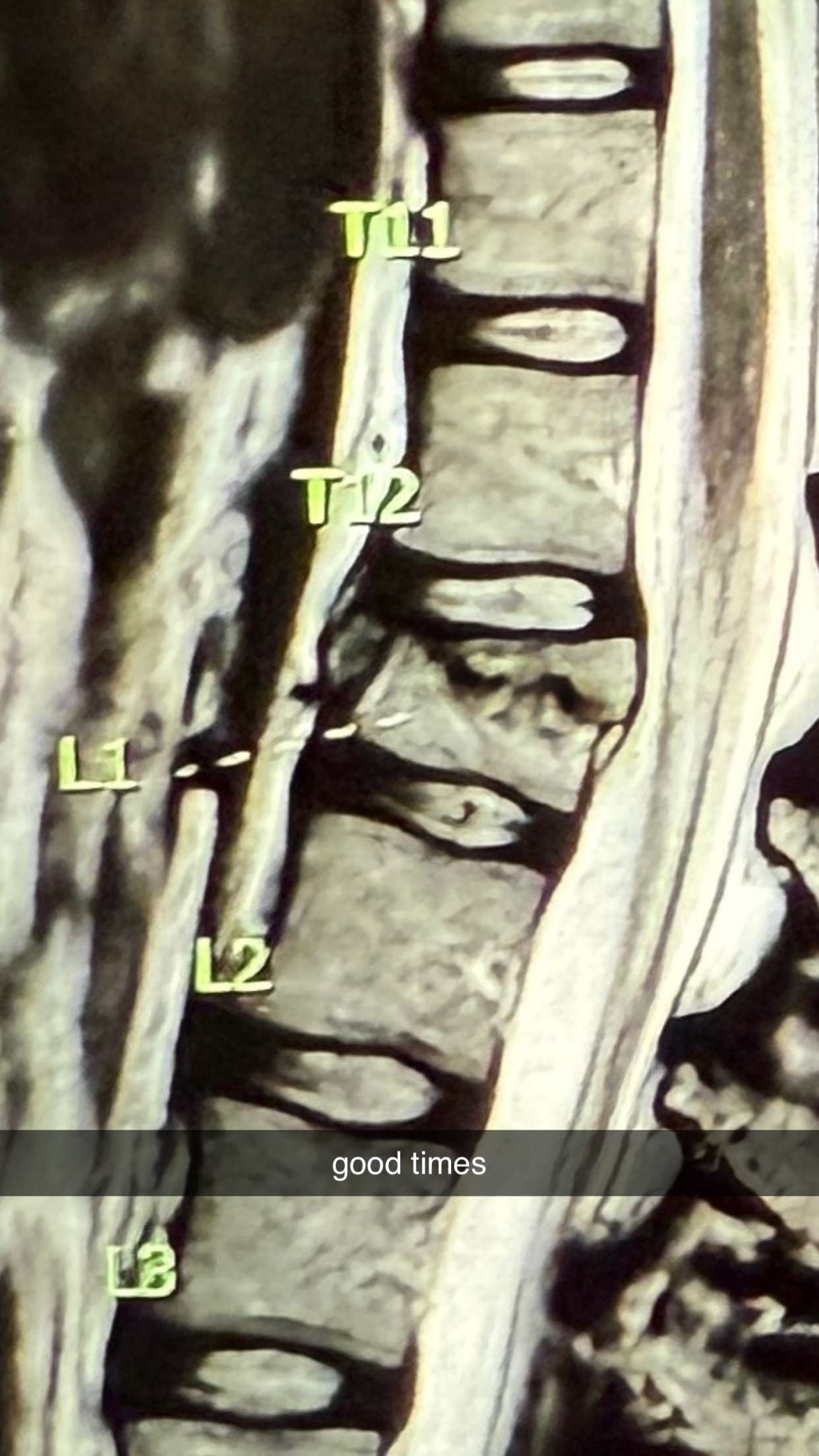 breckiehill snapchat image archive image