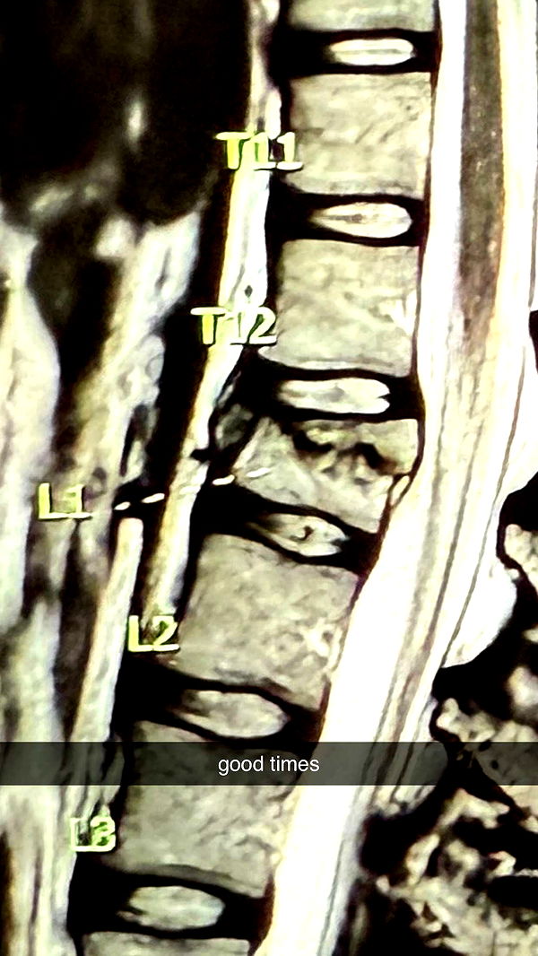 breckiehill image ~ Altpins