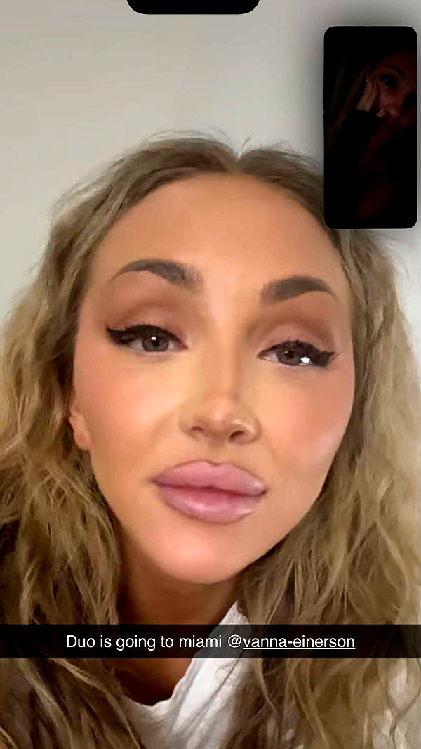 breckiehill image ~ Altpins