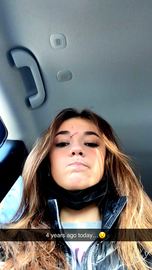 breckiehill image ~ Altpins