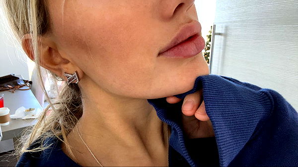 breckiehill image ~ Altpins