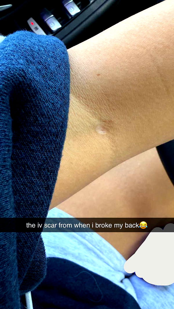 breckiehill image ~ Altpins