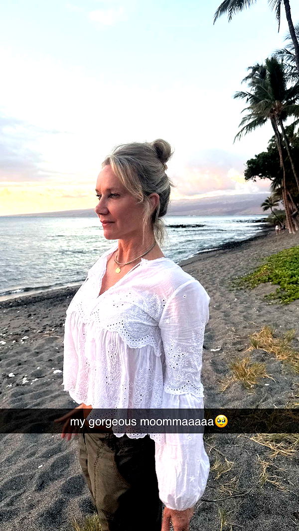 breckiehill image ~ Altpins