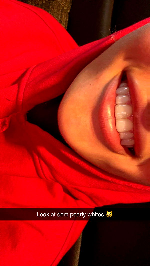 breckiehill image ~ Altpins