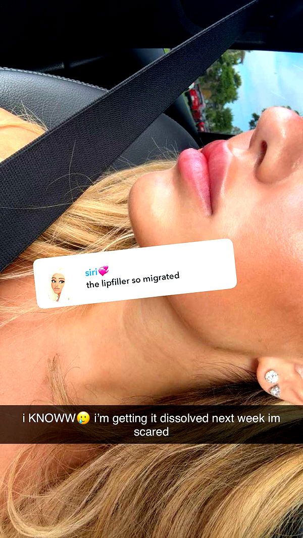 breckiehill image ~ Altpins