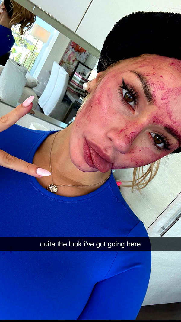 breckiehill image ~ Altpins