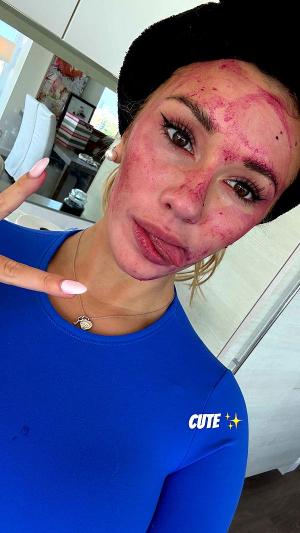 breckiehill image ~ Altpins