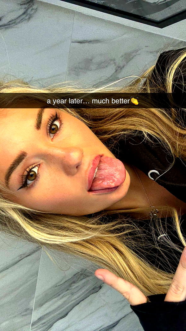 breckiehill image ~ Altpins