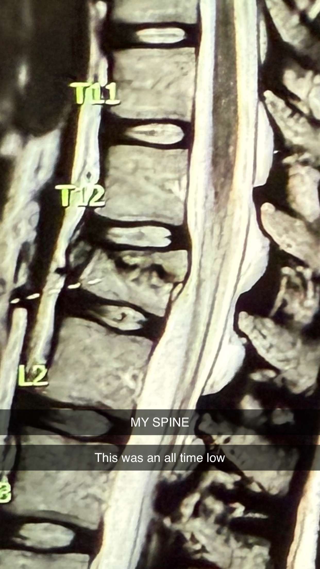 breckiehill snapchat image archive image