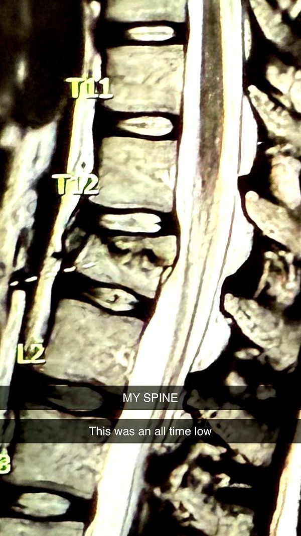 breckiehill image ~ Altpins