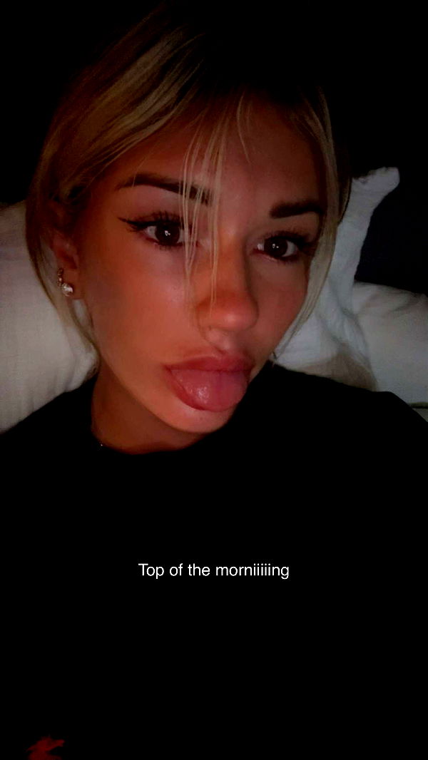 breckiehill image ~ Altpins