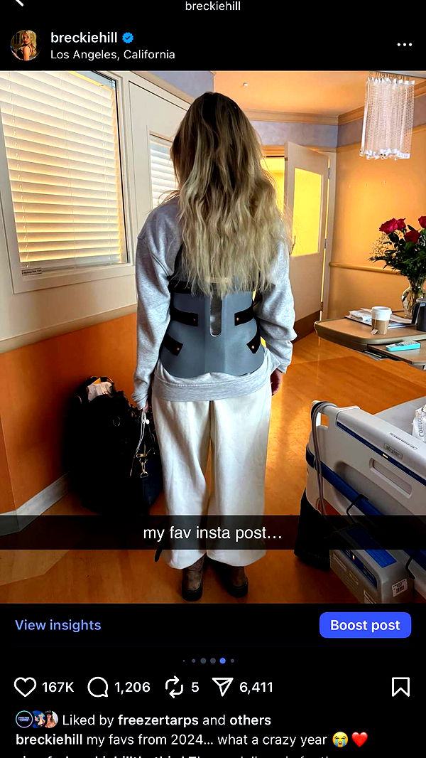 breckiehill image ~ Altpins