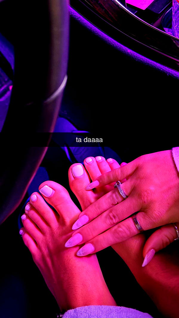 breckiehill image ~ Altpins