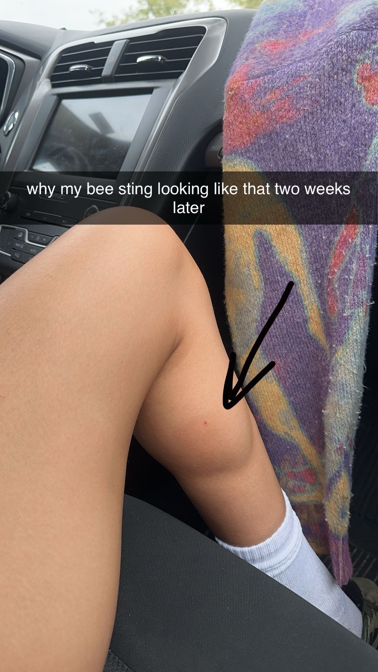 c.aitknight snapchat image archive image