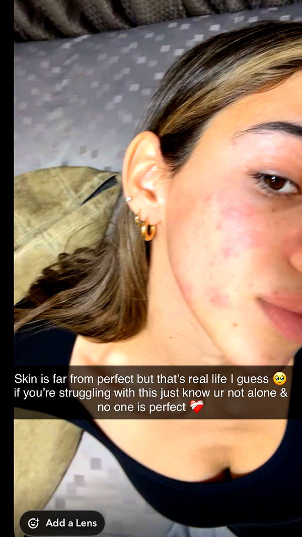 caroworld00 image ~ Altpins