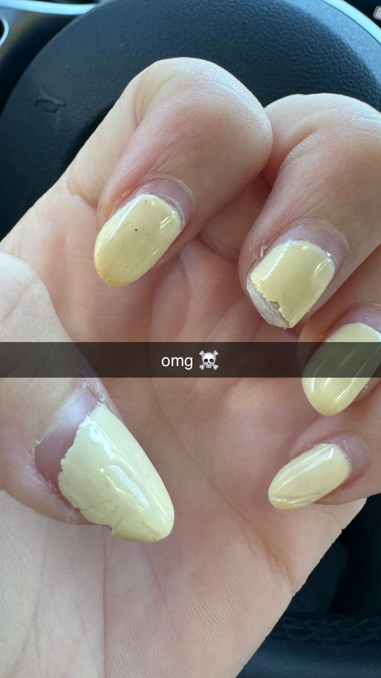 chloerosenbaum snapchat image archive image