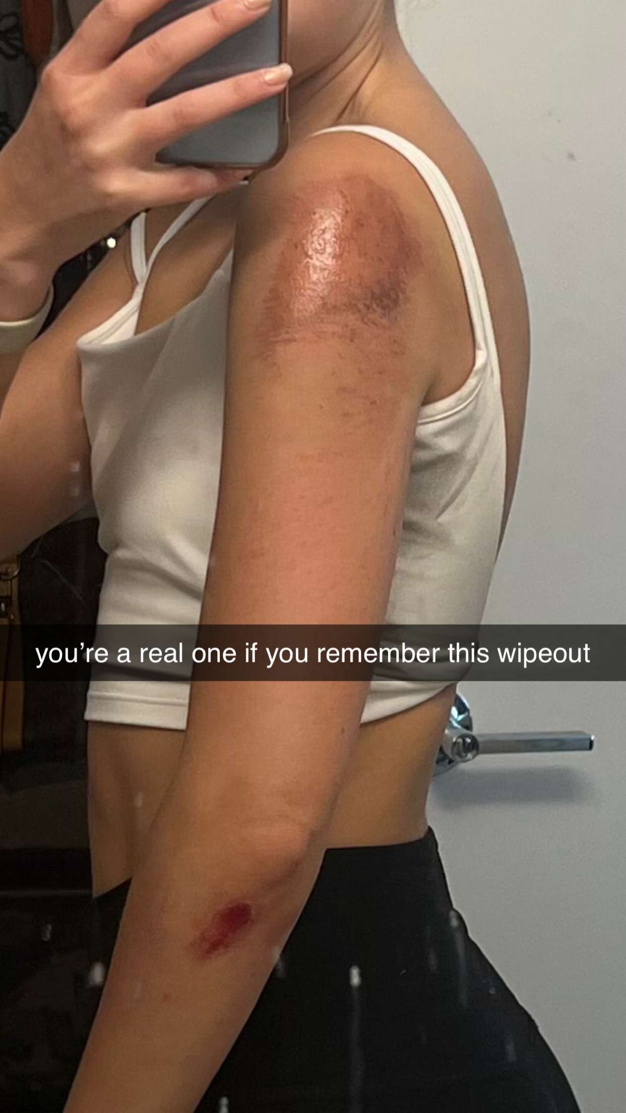 chloerosenbaum snapchat image archive image