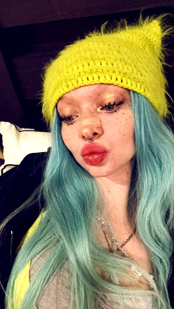 endangerdreamer image ~ Altpins