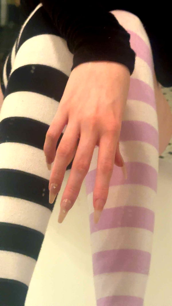 endangerdreamer image ~ Altpins