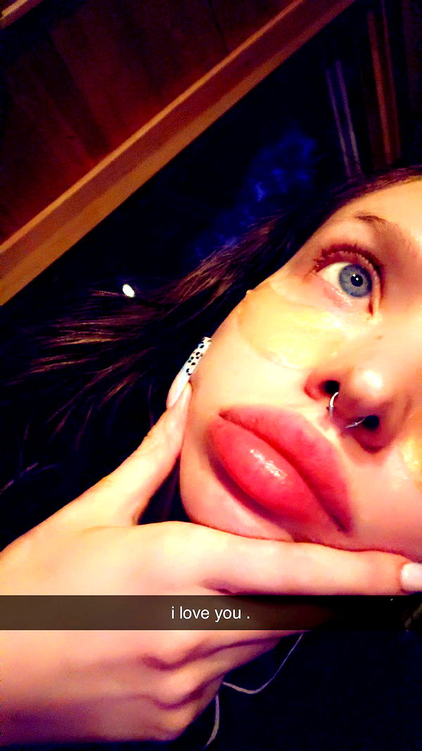 endangerdreamer image ~ Altpins