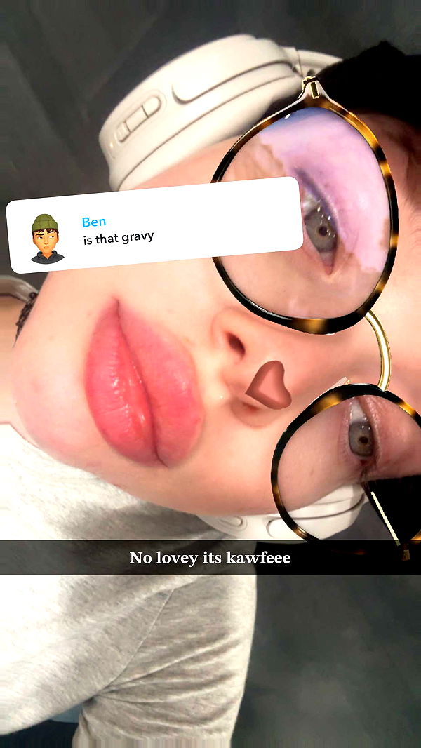 endangerdreamer image ~ Altpins