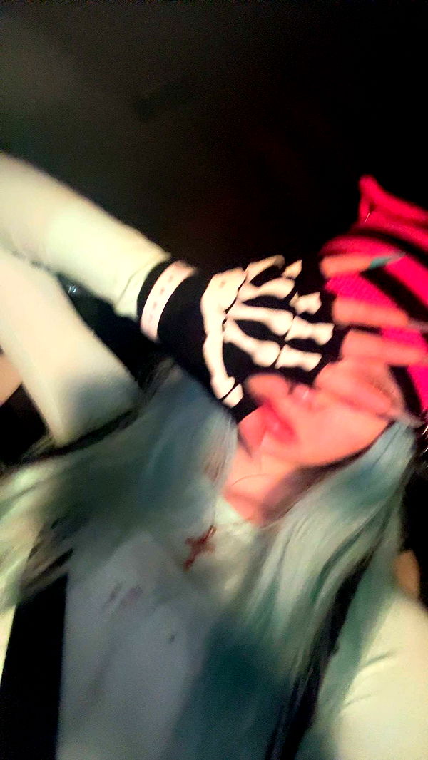 endangerdreamer image ~ Altpins