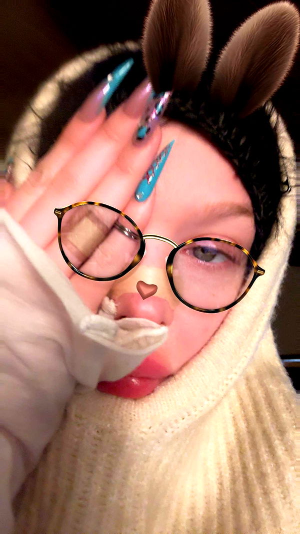 endangerdreamer image ~ Altpins