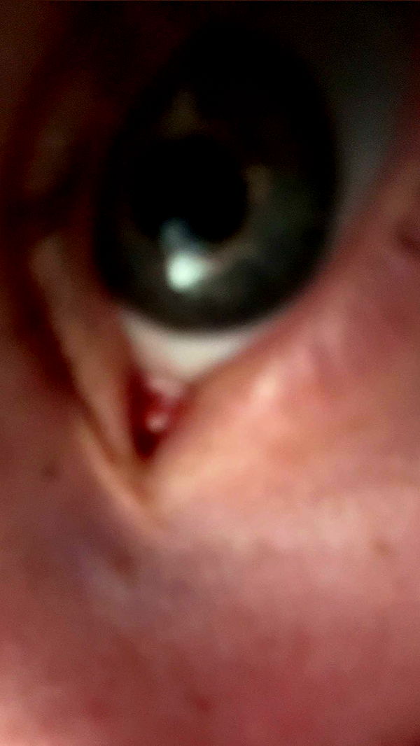 endangerdreamer image ~ Altpins